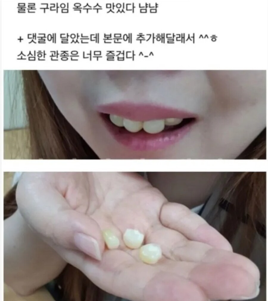 앞니가 너무 못생긴 여자