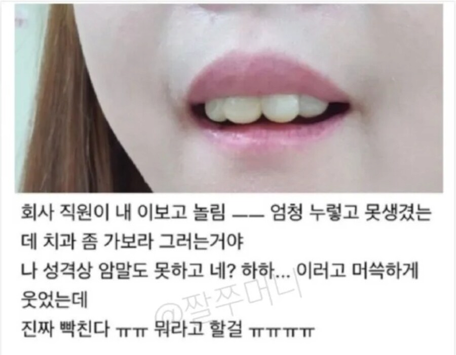 앞니가 너무 못생긴 여자