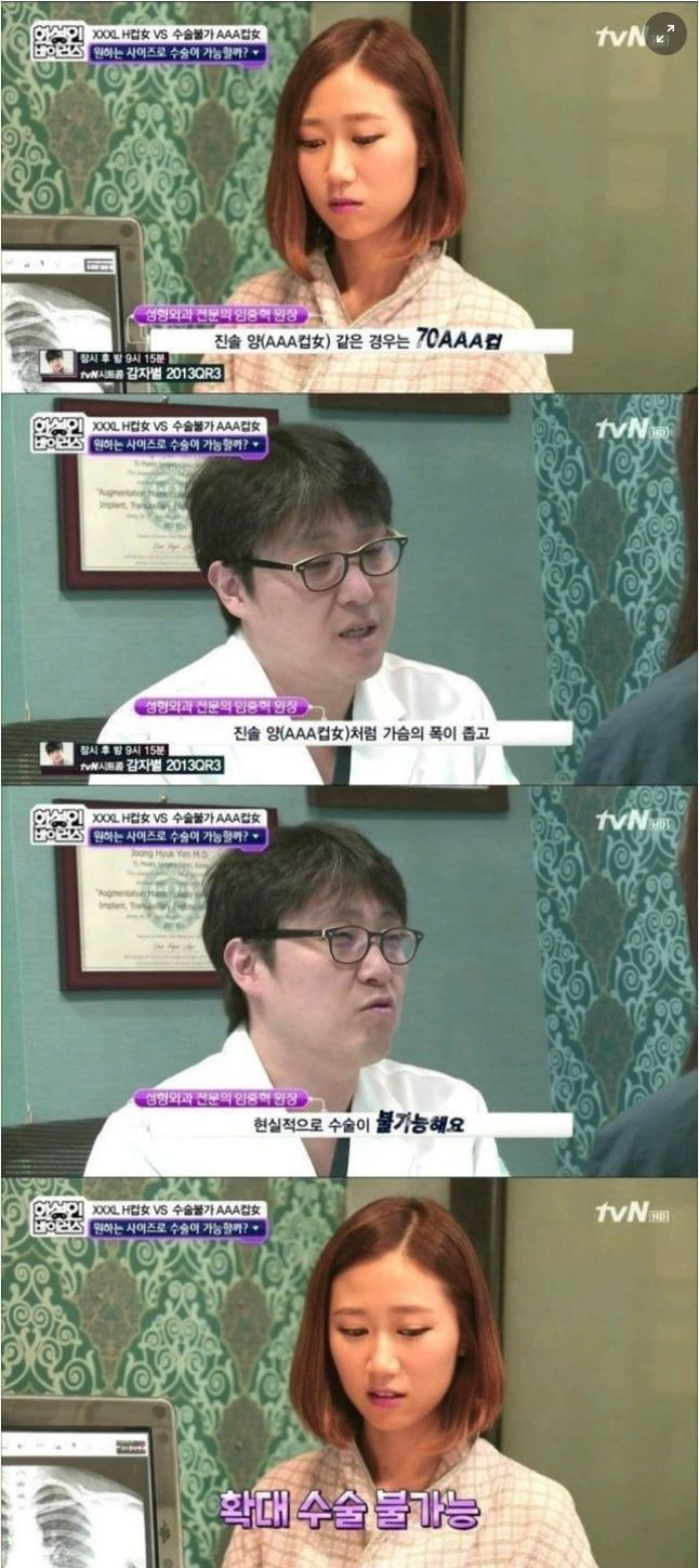 AAA컵녀 가슴수술 레전드