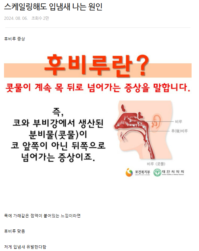 스케일링해도 입냄새 나는 원인