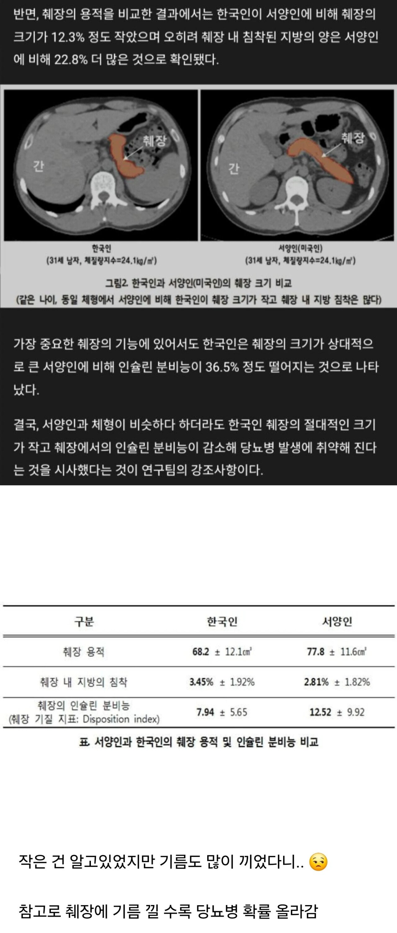 생각보다 작고 소중한 한국인 췌장